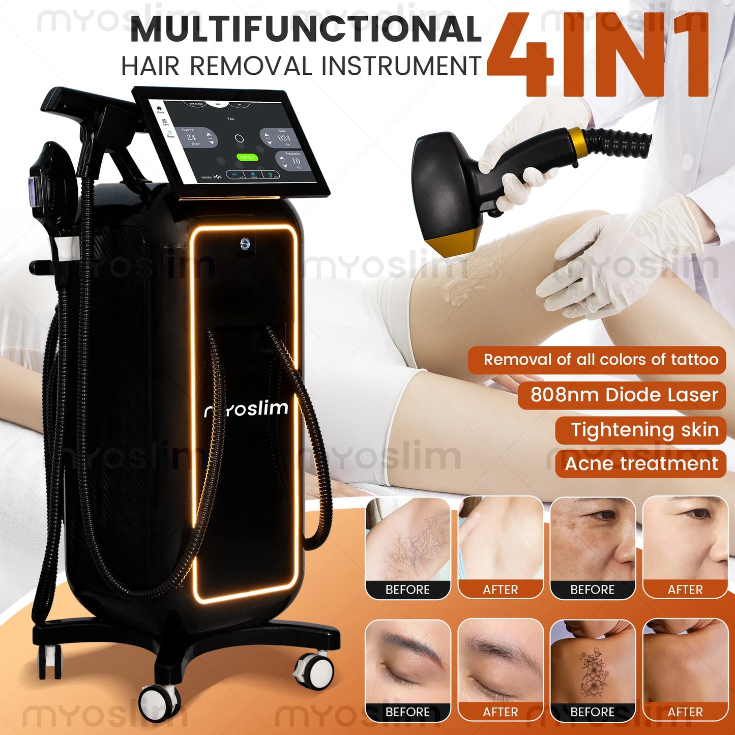 Myoslim 5000W Professional Diode Laser IPL RF Hair Tattoo Machine
