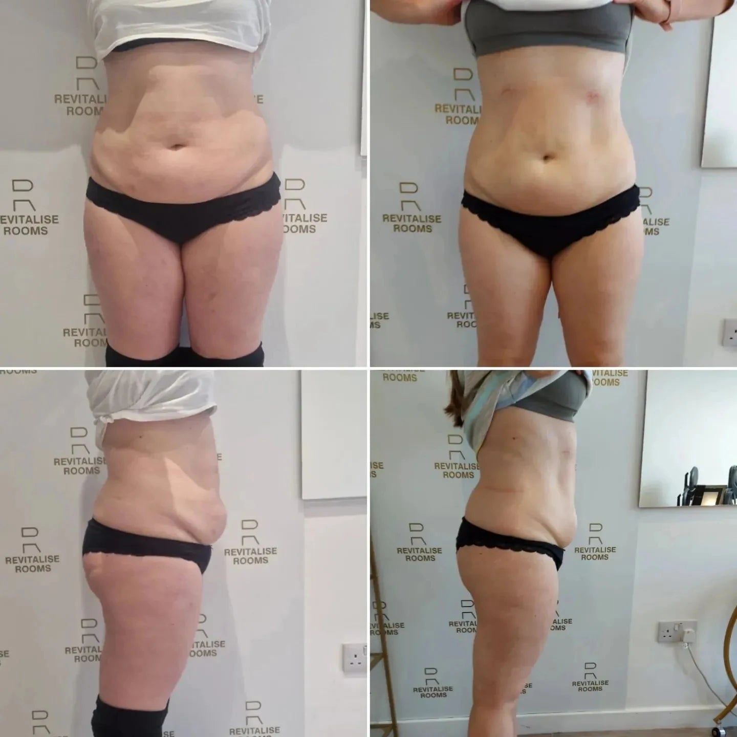 Emszero Neo RF EMS Body Sculpt And Fat Burning Machine